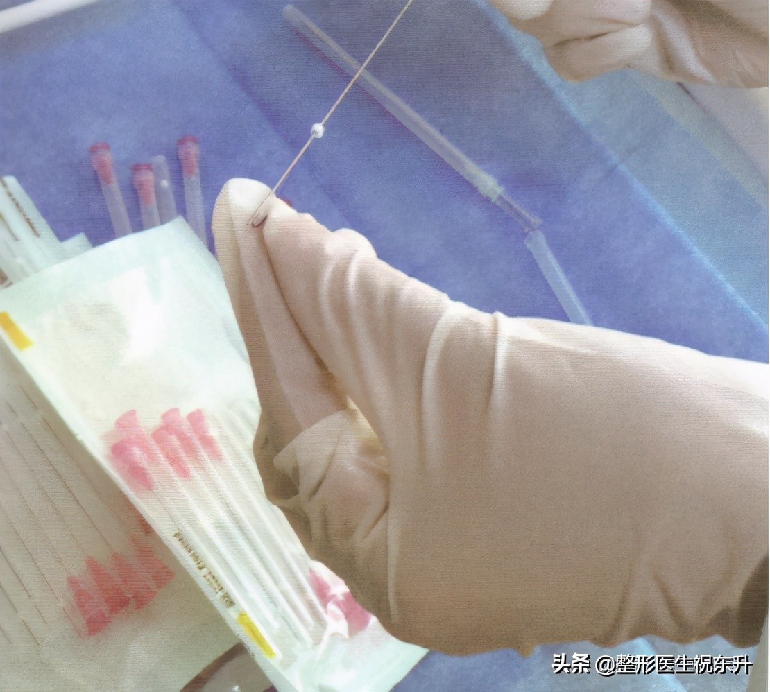 做脸部线雕的材料有区别吗,线雕面部提升什么线材好