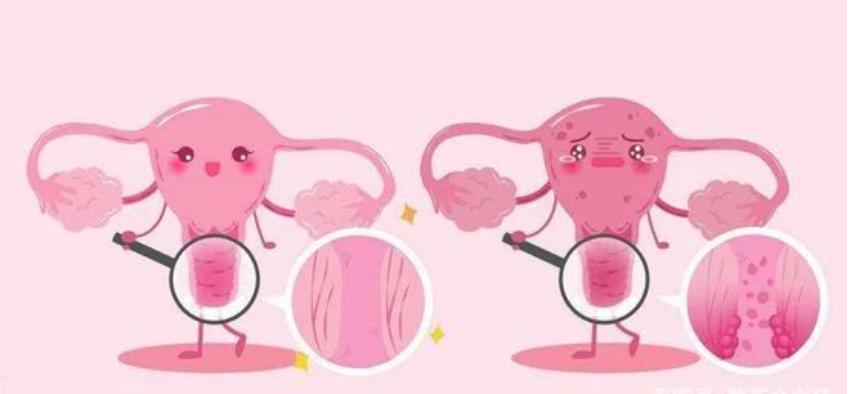 宫颈恶性病变英文,宫颈恶性肿瘤早期症状有哪些