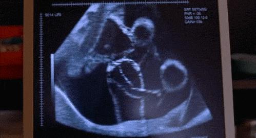 怀孕后吃得太多对胎儿有影响吗,怀孕吃得少会影响胎儿发育