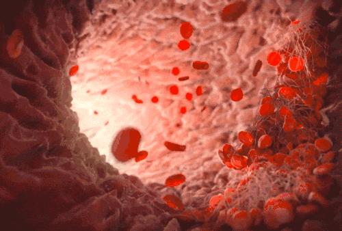 桥本休止期脱发能恢复吗,桥本患者2阳后脱发