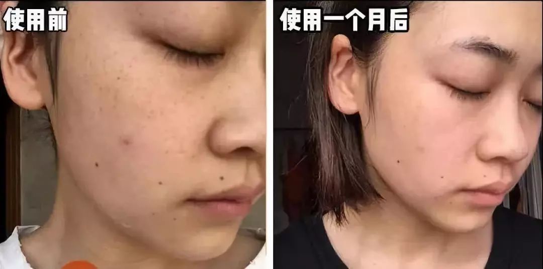 怎样敷水光面膜,明星每天敷面膜