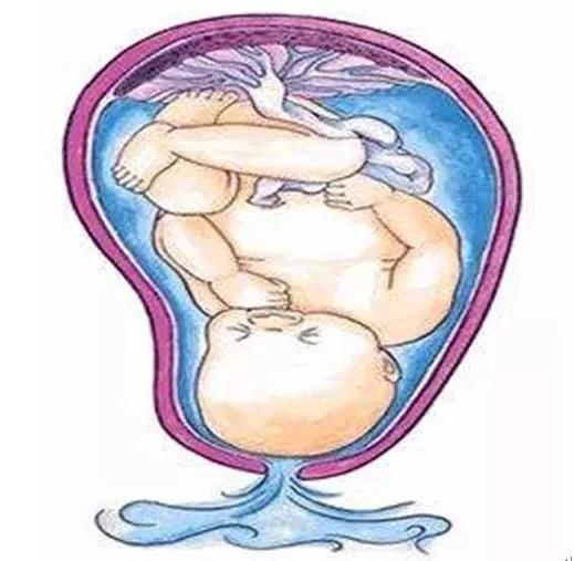 “阴道炎”反反复复？小心，别误了好“孕”来