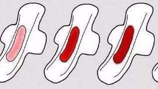 姨妈偏褐色的原因,姨妈偏黑是怎么回事