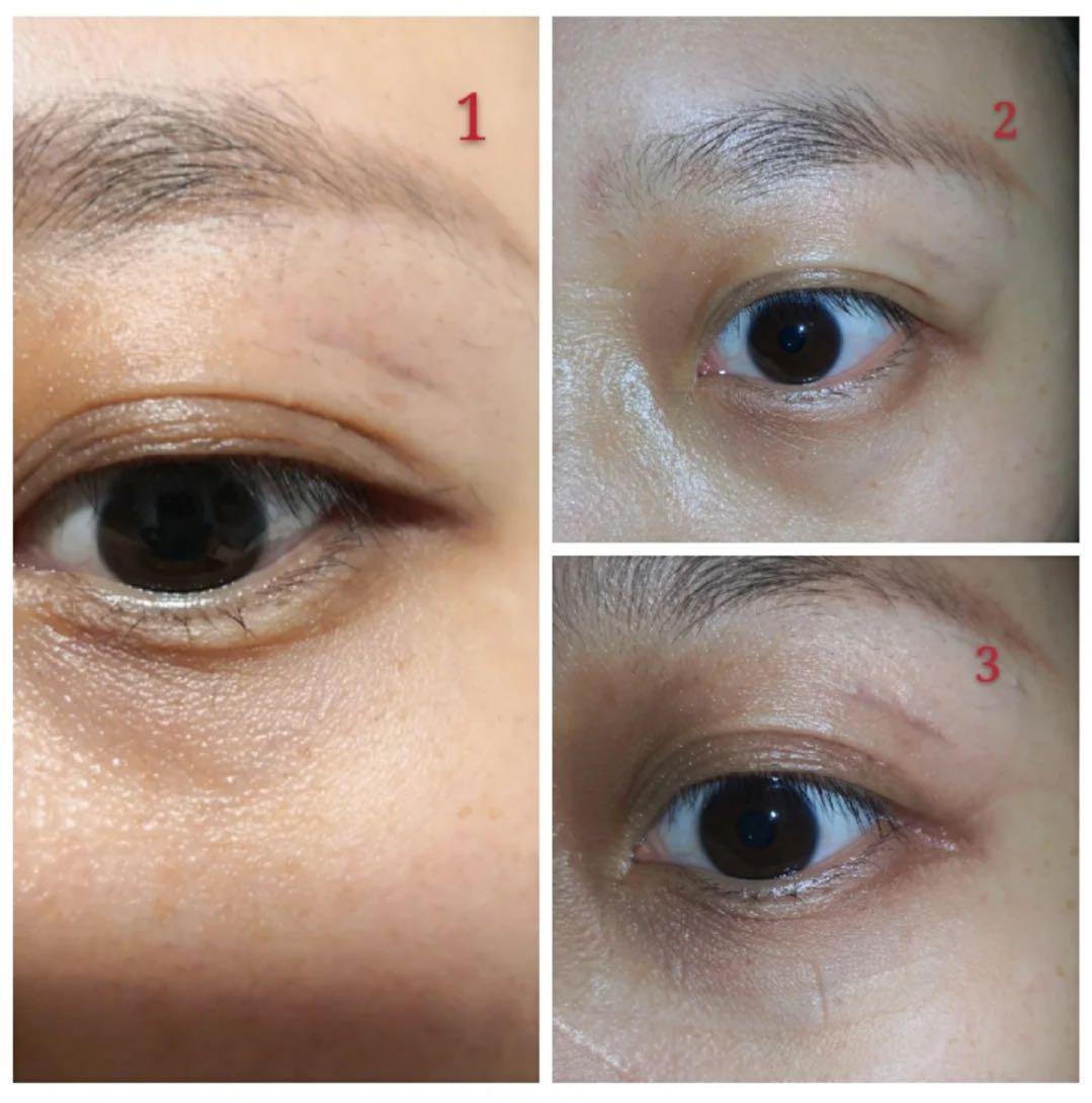 肖战王一博贴眼膜,肖战贴眼膜正确方法