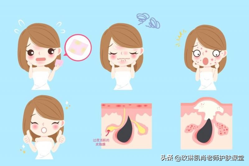 额头下巴后背长痘痘是怎么回事,额头下巴下颌线长痘是什么原因