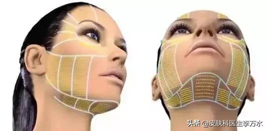 张雨绮说超声刀就像在烤肉?!线雕和超声刀,究竟哪个更靠谱?