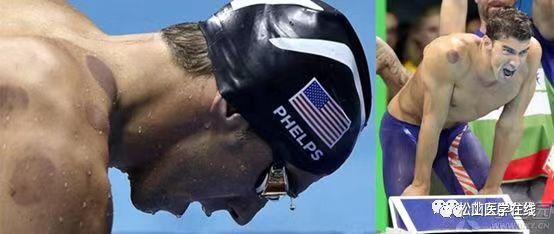 美国军队中的中医,美军应用中医针灸治病