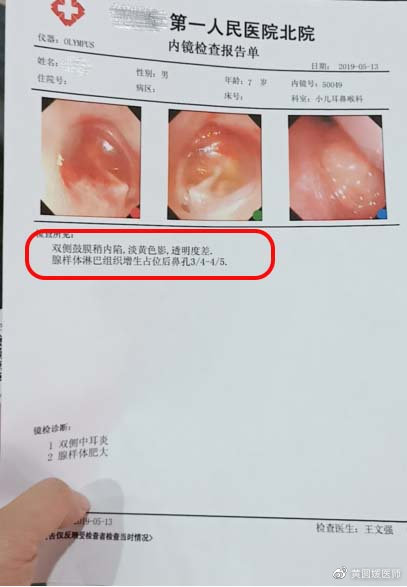 孩子长不高很瘦吃什么钙片,长不高缺钙应该吃什么