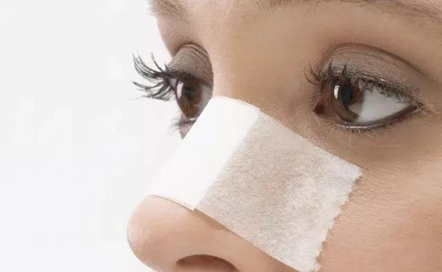 名门泽佳祛斑最佳方法,名门泽佳祛黑斑的方法