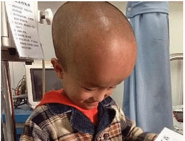 12年前的大头娃娃现在怎么样了,大头娃娃假奶粉事件发生哪一年