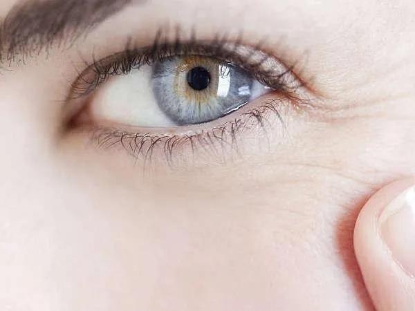 脸上细纹干纹皱纹怎么遮盖,细纹和皱纹怎么治疗