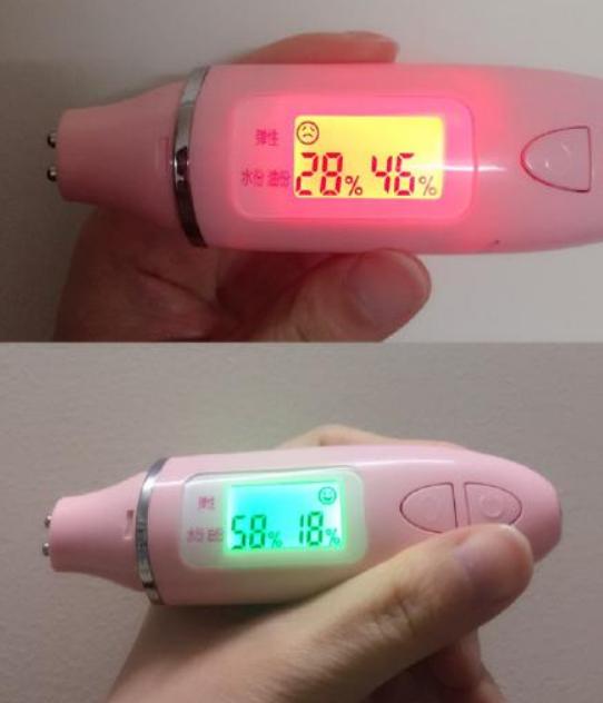 美容针变“毒针”，19岁女孩被毁容，医生：打针有风险跟风需谨慎