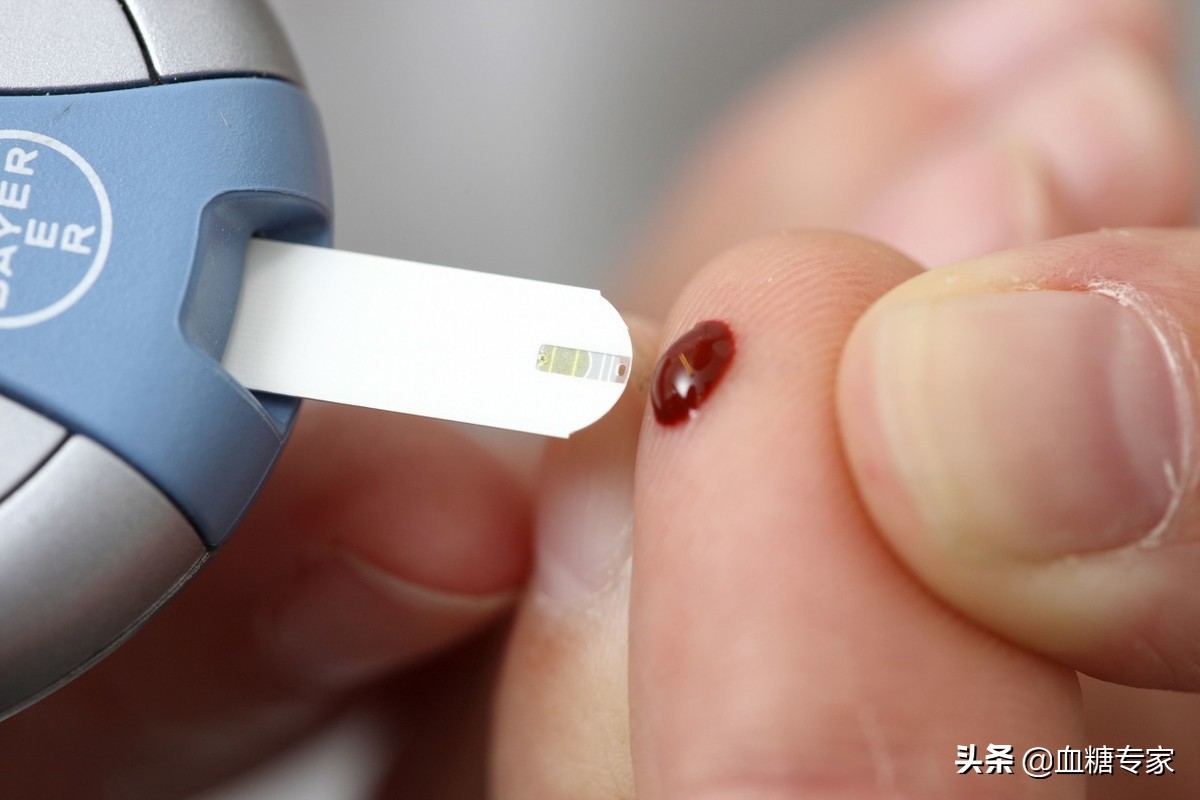 糖尿病足部检查去哪个科室,糖尿病周围神经病变挂哪个科室