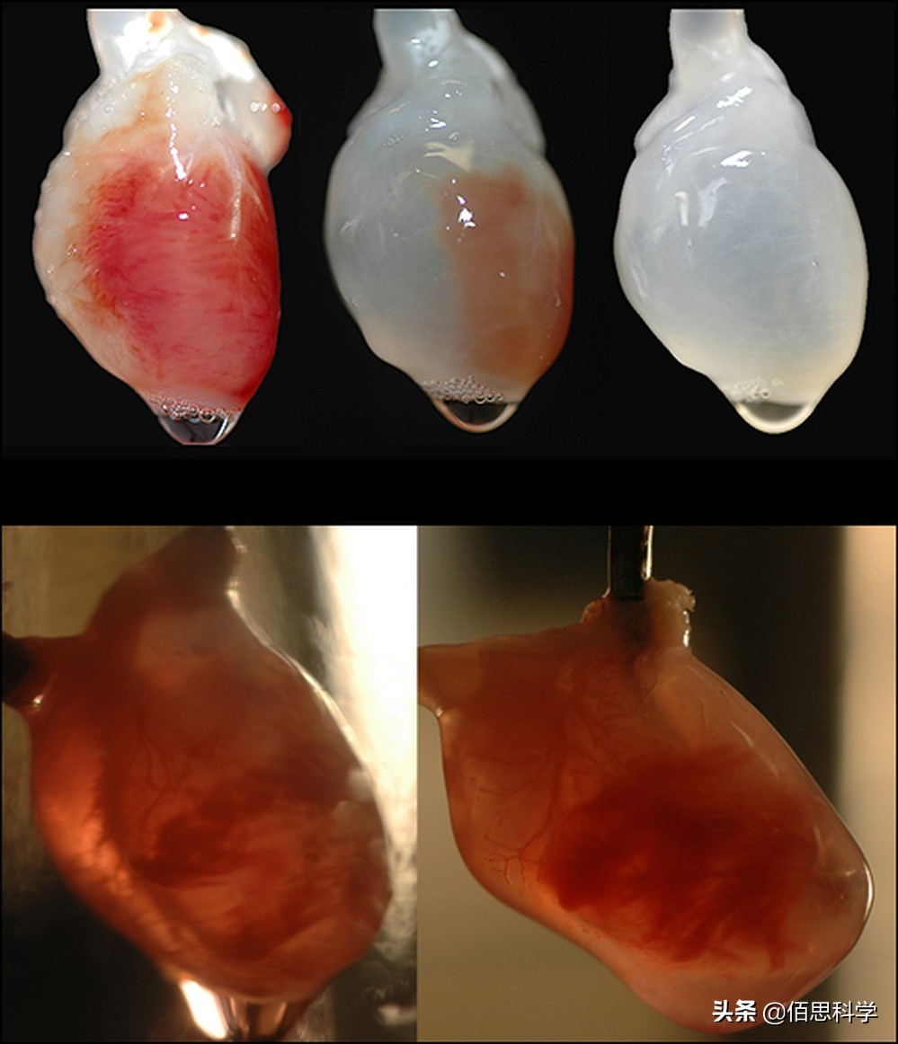 阿兹海默症跟失智症一样吗,阿兹海默病是帕金森吗