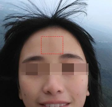 道士说印堂发黑有血光之灾的视频,印堂发黑是有血光之灾吗