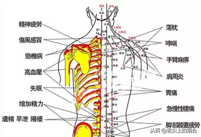 你知道拔罐后，会怎样么？真的太吓人了，看看吧！