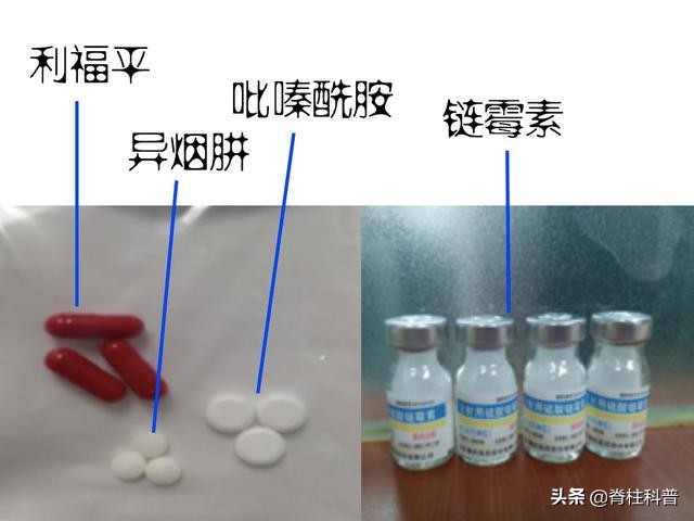 结核药物不良反应哪些,各类抗结核药的不良反应