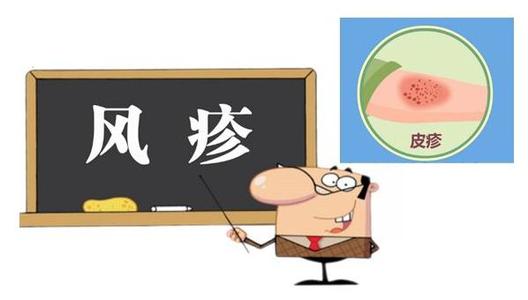 小朋友得了风疹怎么办,风疹小儿艾灸