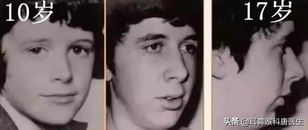 为什么一换季鼻炎就发作,换季鼻炎就发作吃什么药