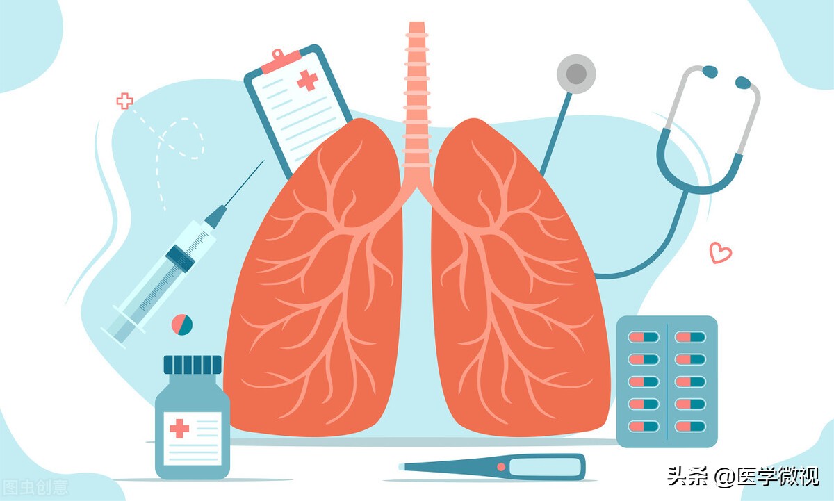 微创治疗肺癌最终是什么结果,肺癌的发病率和死亡率最新数据