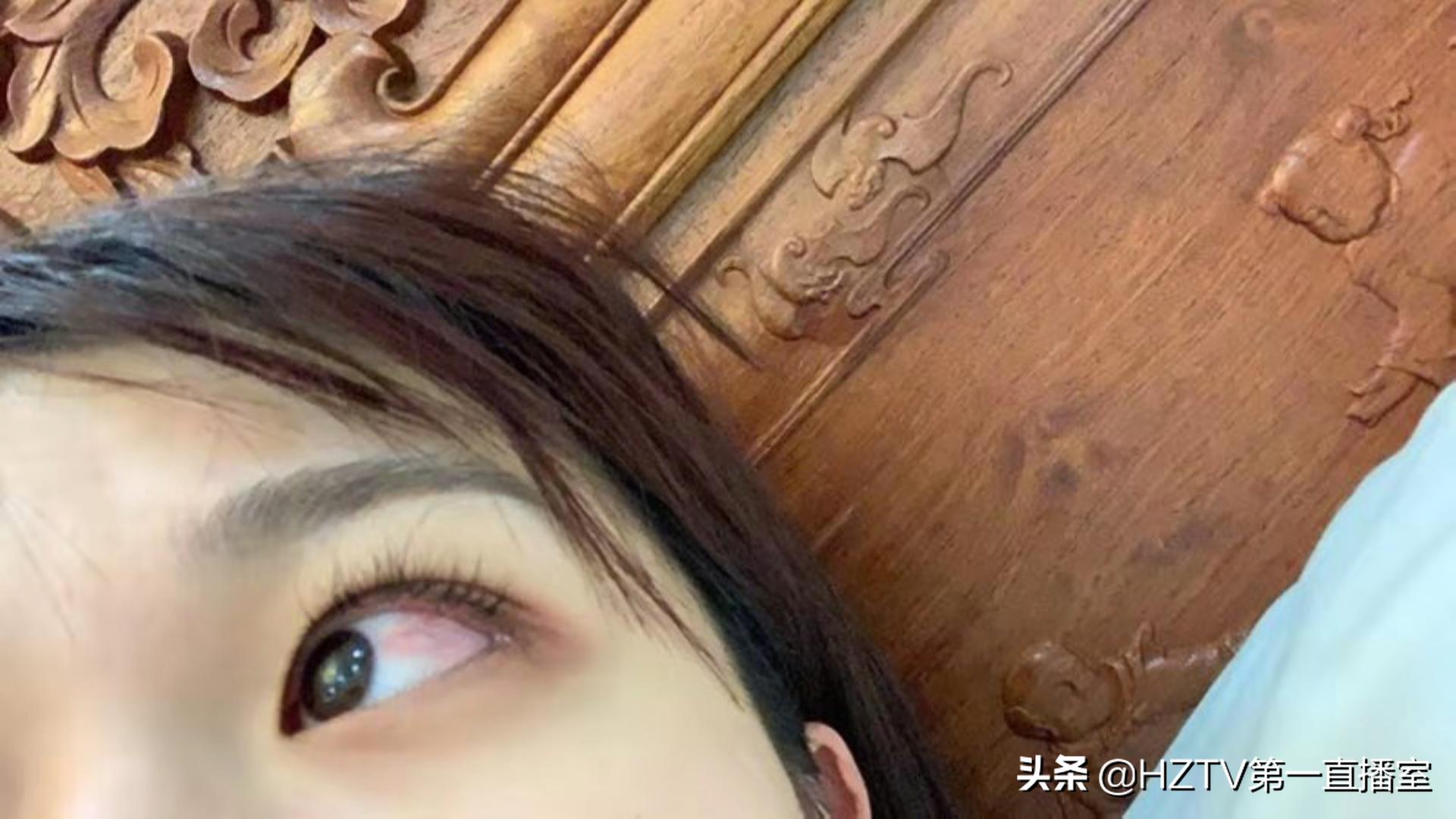 妙龄少女“眼中刺”竟是仙人掌惹得祸