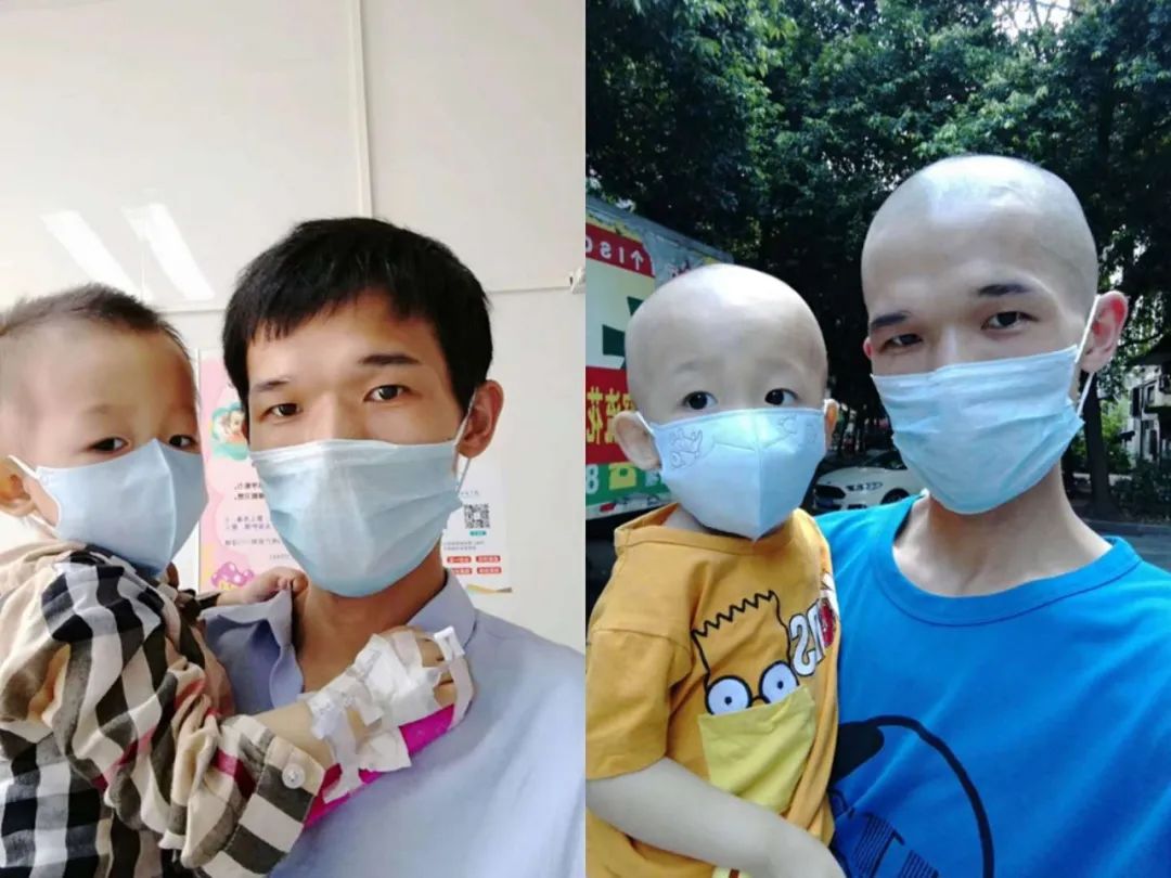 老公抗癌头发剃光,头发剃光的抗癌男孩