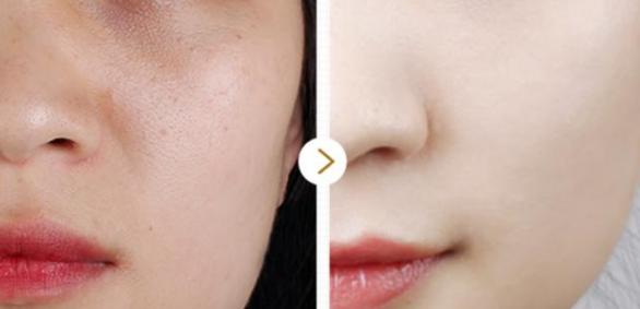 要想皮肤好用什么护肤品,伊能静去皱面霜