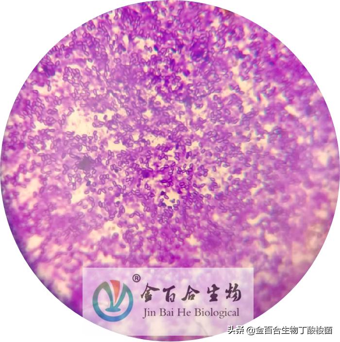 革兰氏染色显微镜下的图手绘,革兰染色用的显微镜是什么