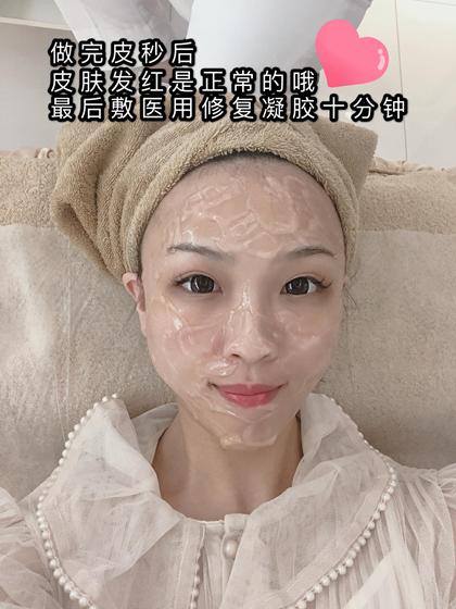 香港pico祛斑怎么样,香港皮秒淡斑