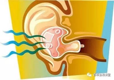 蒋子栋治疗耳鸣,协和医院蒋子栋治疗耳鸣的方法