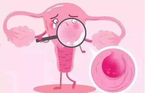 子宫肌瘤癌变怎么办？要切除子宫吗？听听妇科医生怎么说的