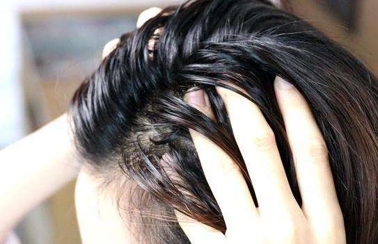 头皮上总长痘痘,头皮上长痘痘抠破了怎么办