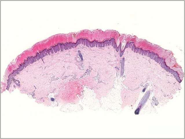 皮肤瘙痒要不要挠,皮肤瘙痒的让人抓狂10种止痒妙方