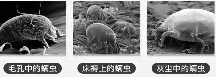 男生螨虫脸特征,螨虫脸的特征