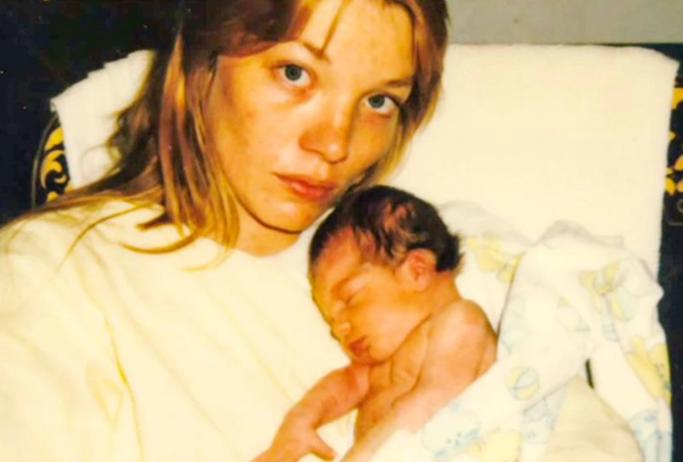 80年代移植狒狒心脏的婴儿,第一个移植狒狒心脏的美国女孩