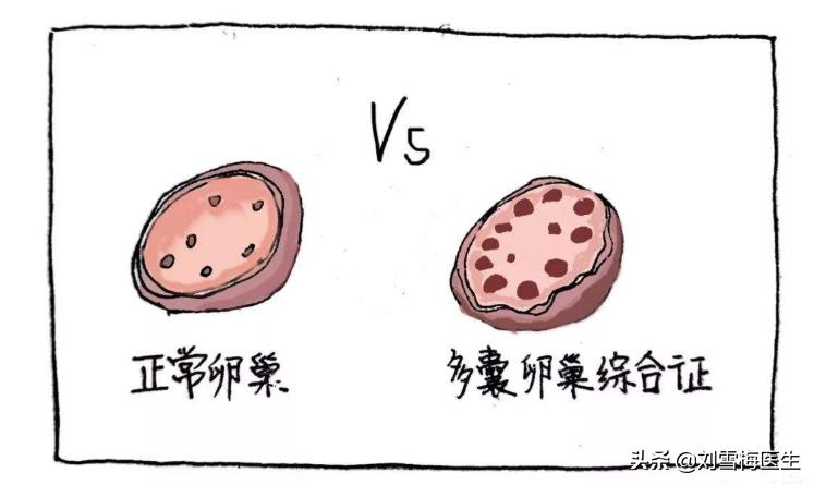 amh怎么看卵巢情况,amh是判断卵巢功能的标准吗