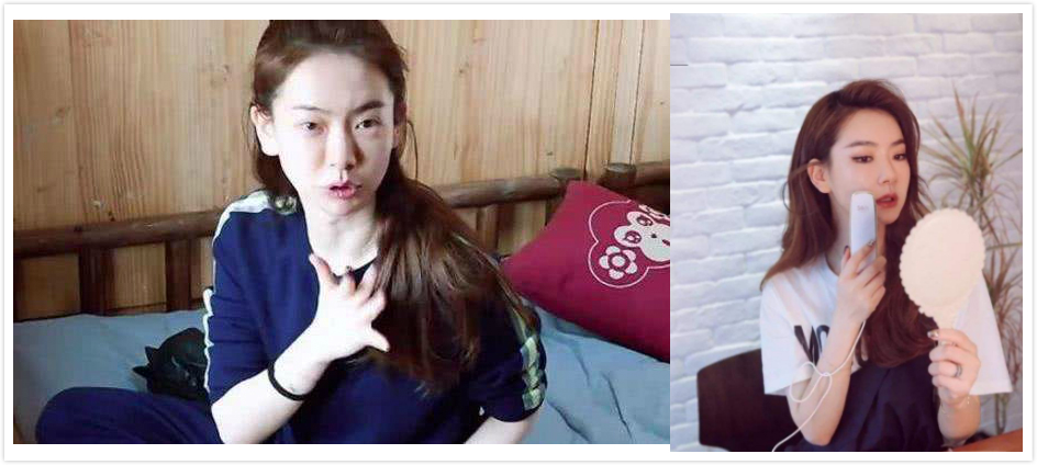 杨幂做了什么医美,杨幂新氧医美