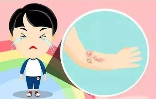 疤痕体质增生疼痛难忍,疤痕疙瘩疼痛痒痒用什么药物