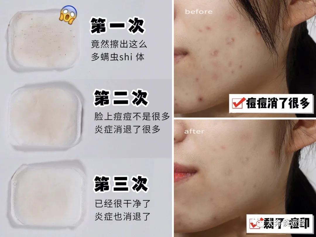 大牌洗面奶哪款好用排行榜最新版,洗面奶到底哪款好用又实惠