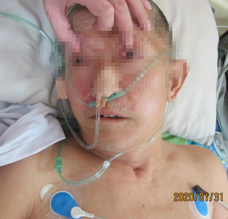 颅脑外伤术后脑积水,脑外伤脑积水颅骨缺失