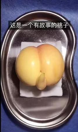 香蕉割包皮，洋葱剖腹产？这是我见过最秀的医生