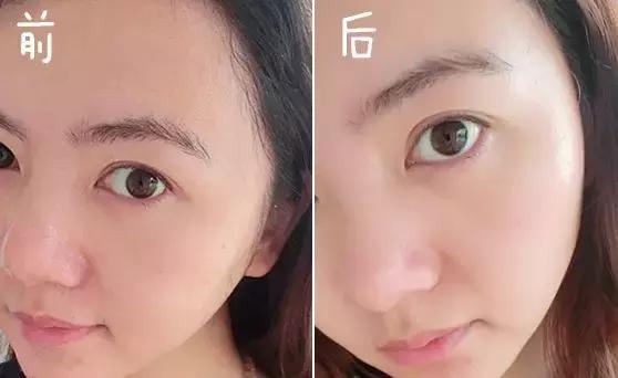 烟酰胺玻尿酸水光焕颜片美白效果,烟酰胺玻尿酸精华液美白淡斑霜