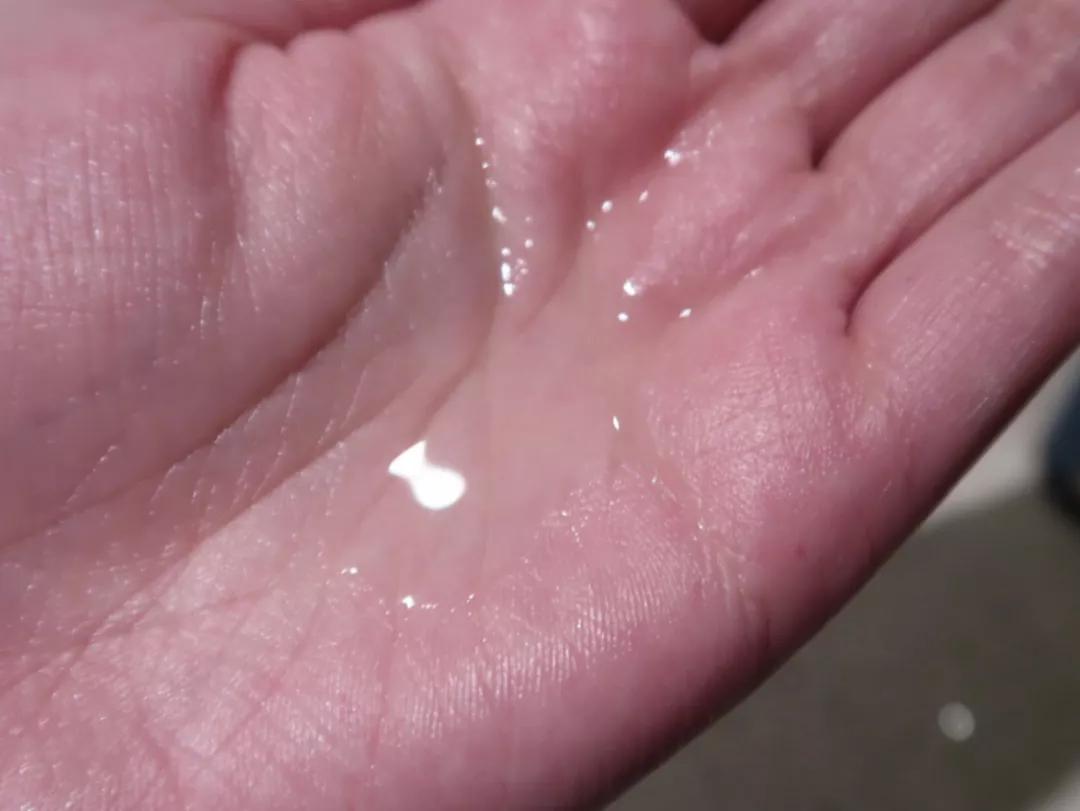 刷酸真的可以换脸吗,刷酸一定要刷全脸吗