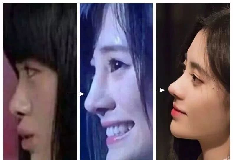 如何分辨鼻子整没整过,如何辨别鼻子有没有整过