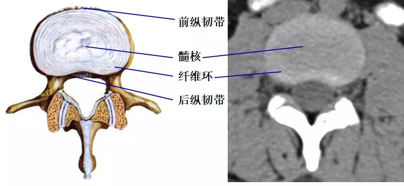 颈椎腰椎疾病ct及mri诊断,腰椎ct可以发现肠部病变吗