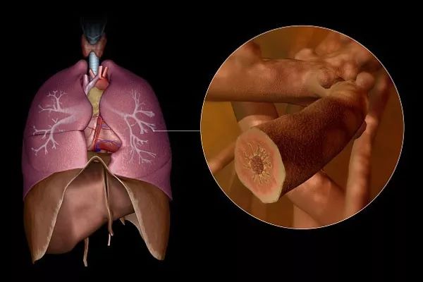 一上班就胸闷气短胸口疼怎么回事,一上班就胸闷气短怎么回事