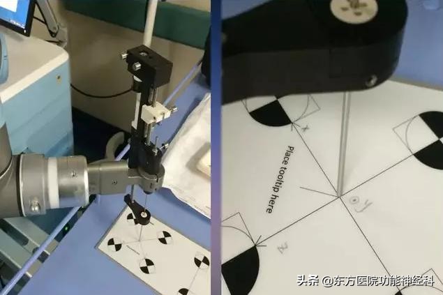 东方医院带你探究DBS能治疗哪些病？