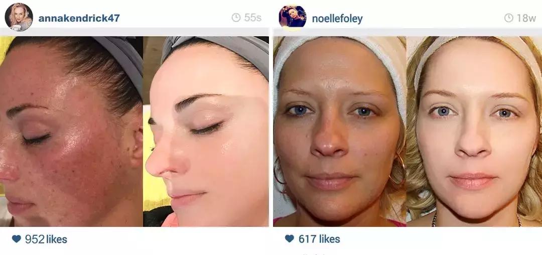 濂界墿娼祦鏉ヨ,鑳跺師鎶楄“绮惧崕