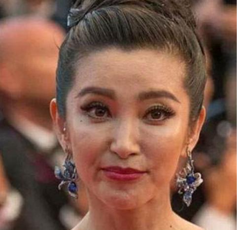 皮肤暗沉无光怎么办,补水精华液皮肤暗黄