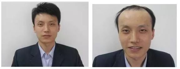 泰国生姜洗发水防脱发,泰国防脱发生姜洗发水